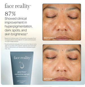 GLOWTONE™ CORRECTIVE SERUM